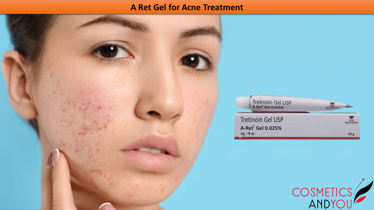 A Ret Gel for Acne Treatment – Cosmetics and you : Acne Treatment