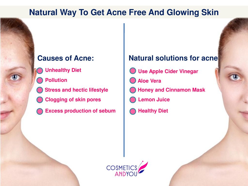 acne-home-remedies-doctor