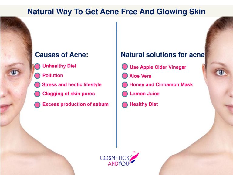 Natural Way to Get Acne Free And Glowing Skin Cosmetics and you