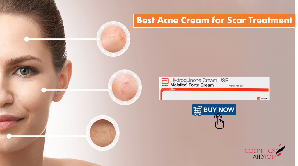 Kojic Acid Cream – Cosmetics and you : Acne Treatment, Careprost ...