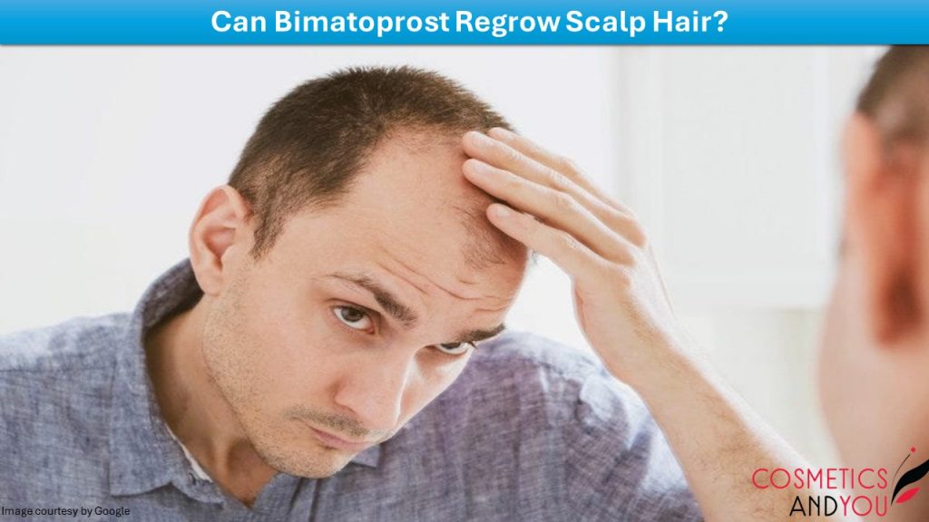 Can Bimatoprost Regrow Scalp Hair? – Cosmetics and you : Acne Treatment ...