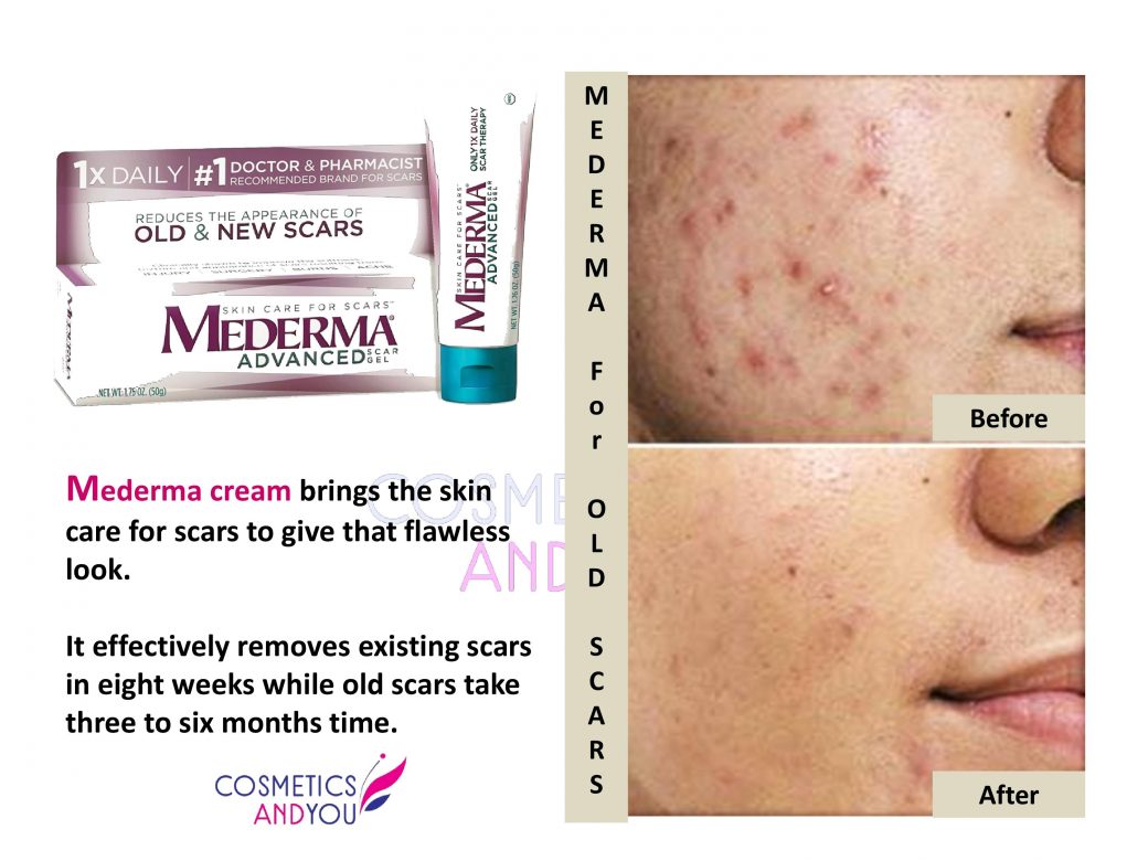 mederma-reviews-for-old-scars-cosmetics-and-you-acne-treatment